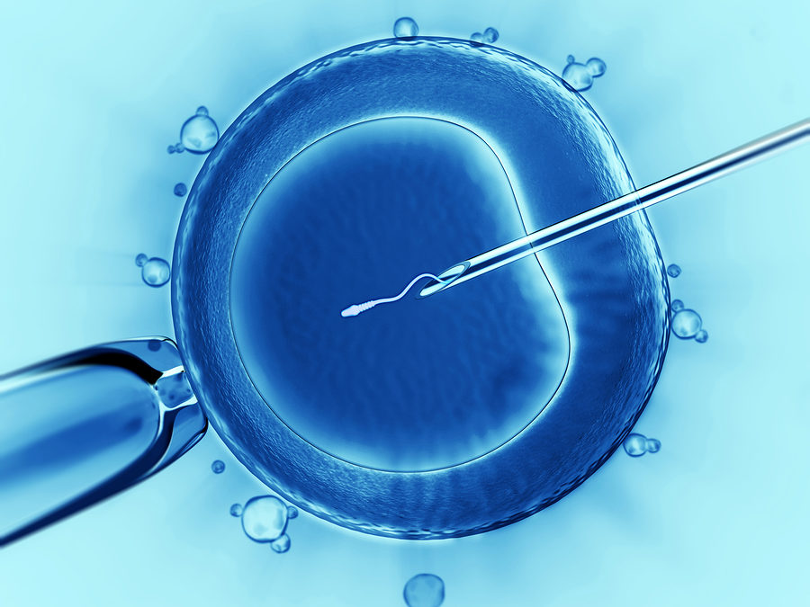 Sperm injection - IVF